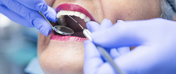 Best Broken or Chipped Tooth Repair in Mustang Ridge, TX